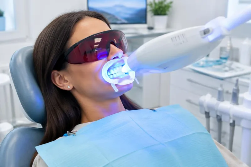 Professional teeth whitening